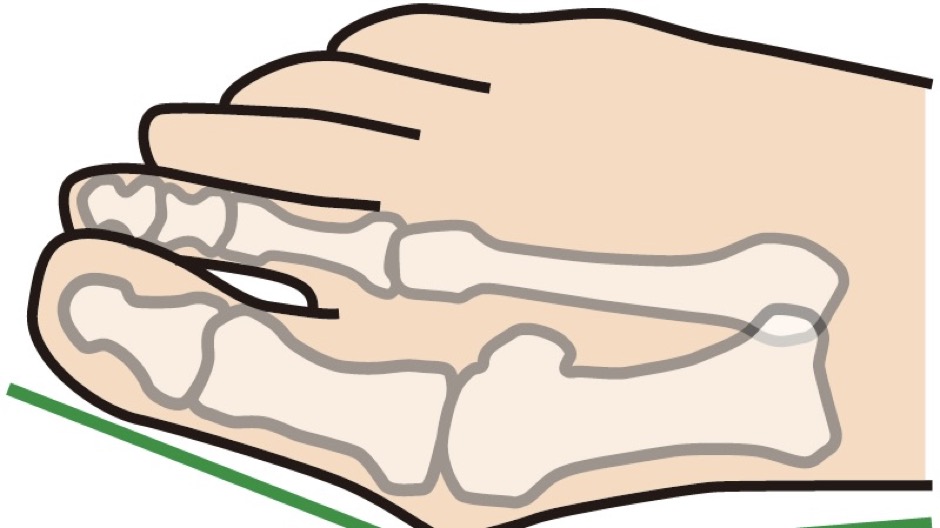 親指の爪が人差し指に当たる防止策-6